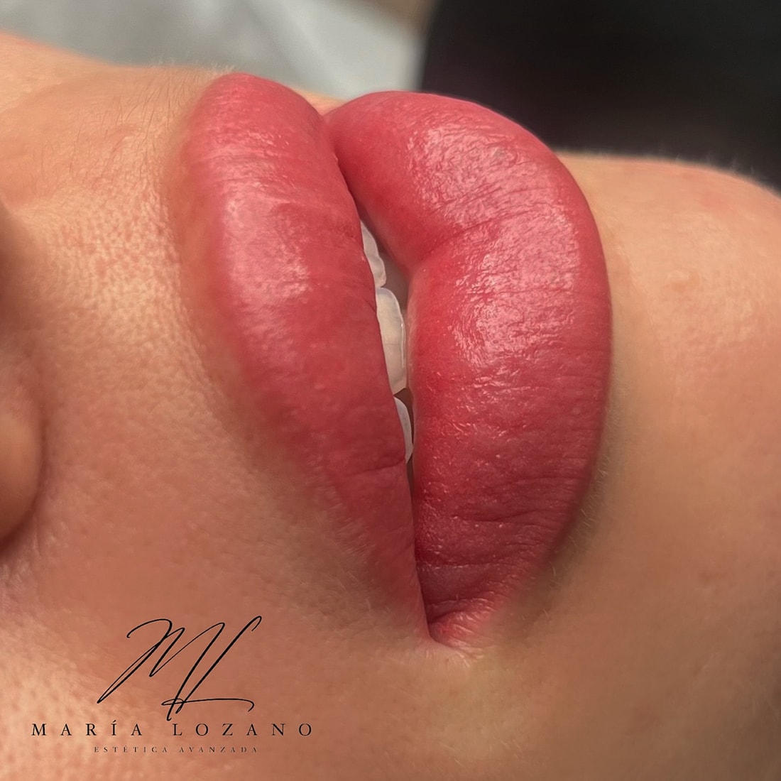 Micropigmentación labial